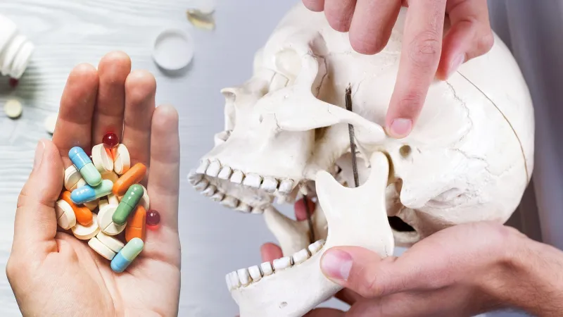 Kemik Erimesi İlacı Kullananlar Dikkat! Çene Kemiğiniz Tehlikede Mi?