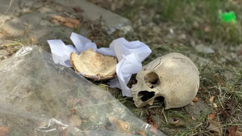 Çöp Kafatası Sırrı Çözüldü! Doktorun 31 Yıllık Mezarlık Anısı mı?